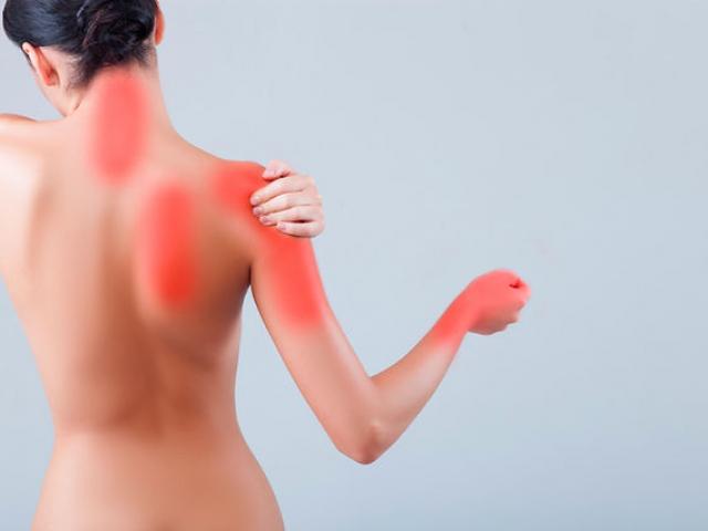 Névralgie cervico-brachiale : quand le cou fait mal jusque dans le bras